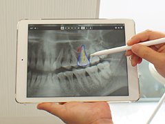 iPadを使用したわかりやすい説明